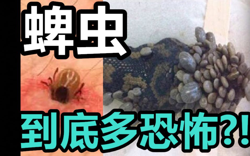 蜱虫到底多恐怖? 城市里也有? 常用预防措施无效?!如何真正防止被蜱虫感染【蜱螨危机(上)】哔哩哔哩bilibili