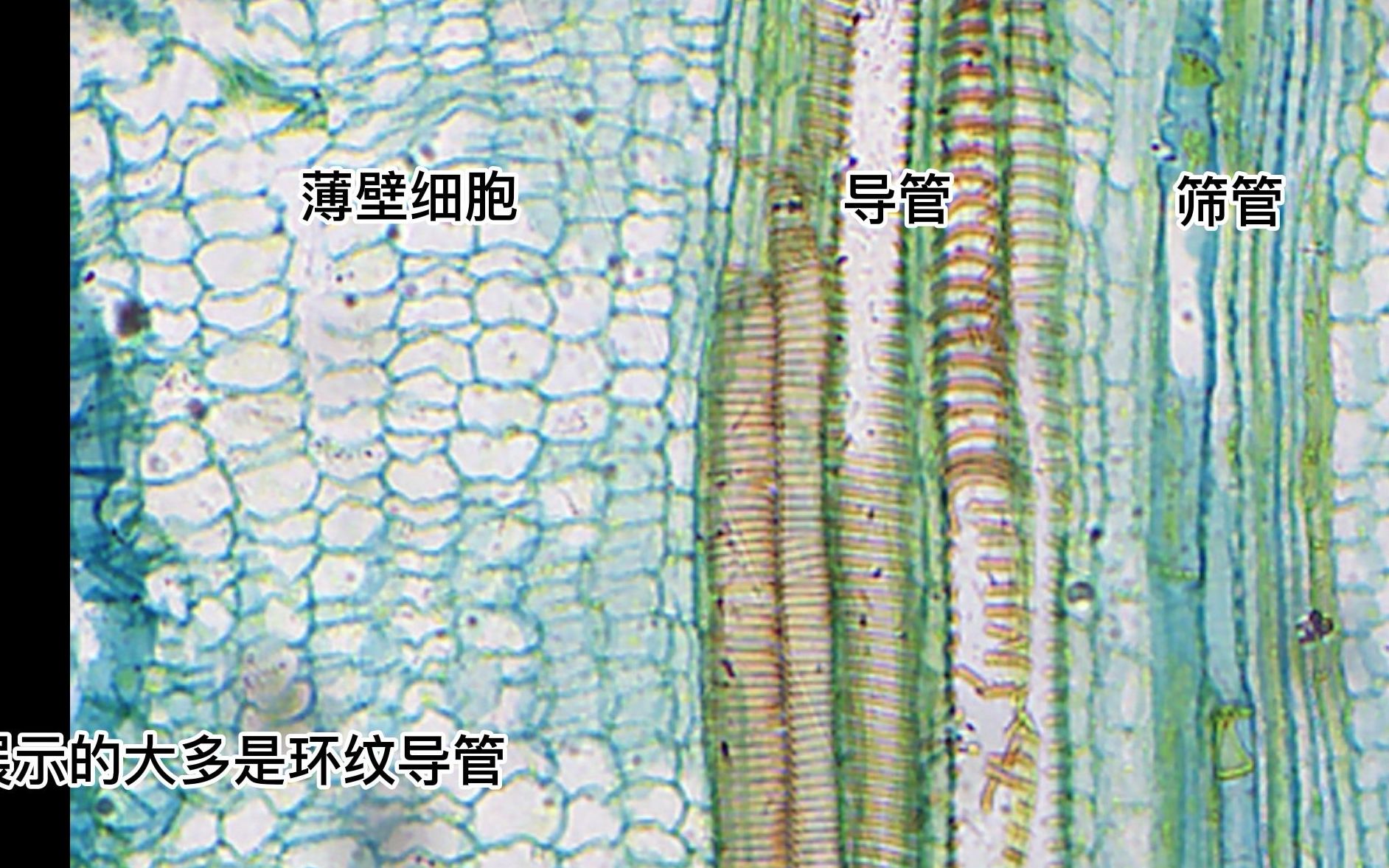 芹菜薄壁细胞图片