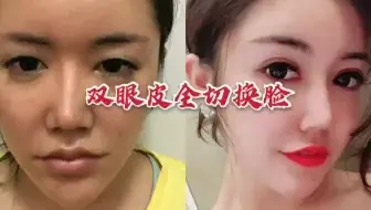 Yappi老湿叫你用魔法药水弄出大大的双眼皮 哔哩哔哩 Bilibili