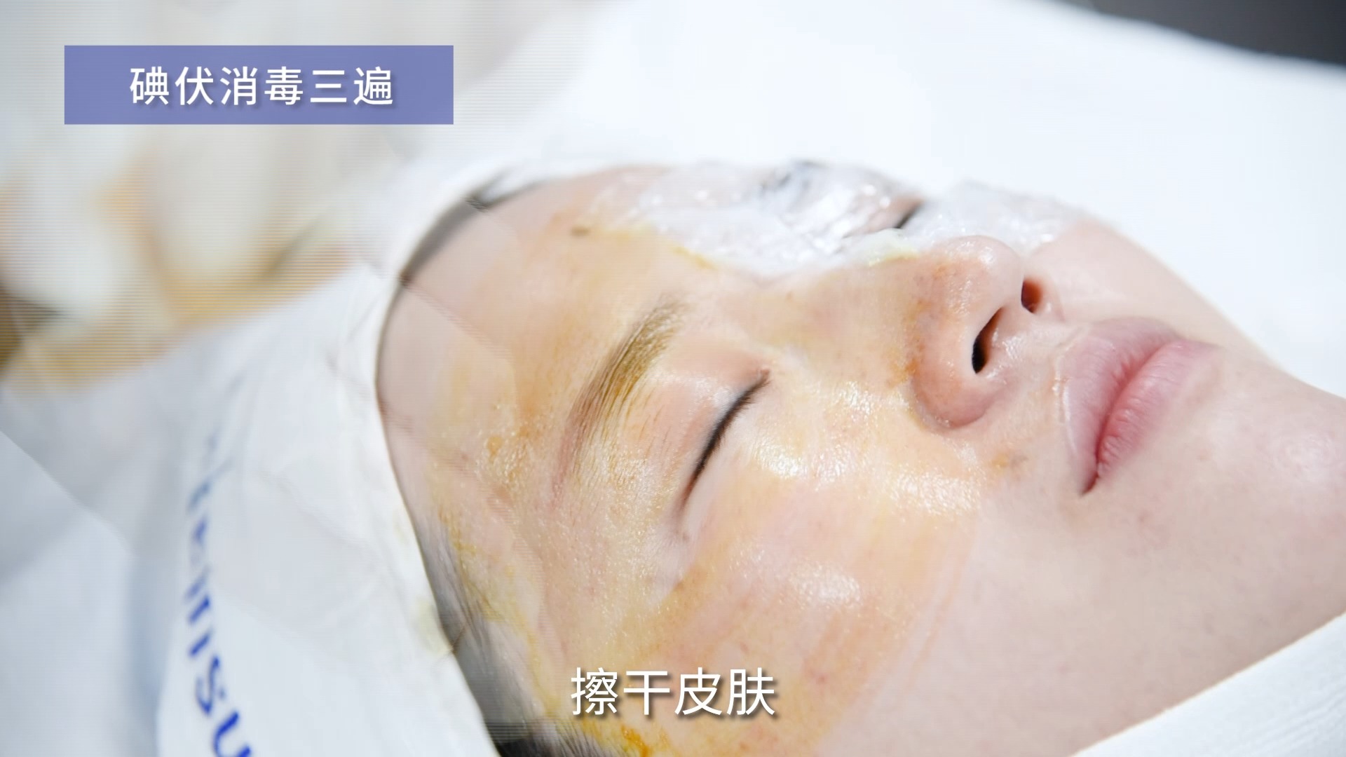 赣州俪人半岛黄金微针新一代逆时针真人实操，解锁肌肤年轻密码