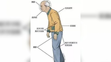 摊则懈惰而不能收摄,缓则弛纵而不能制物哔哩哔哩bilibili