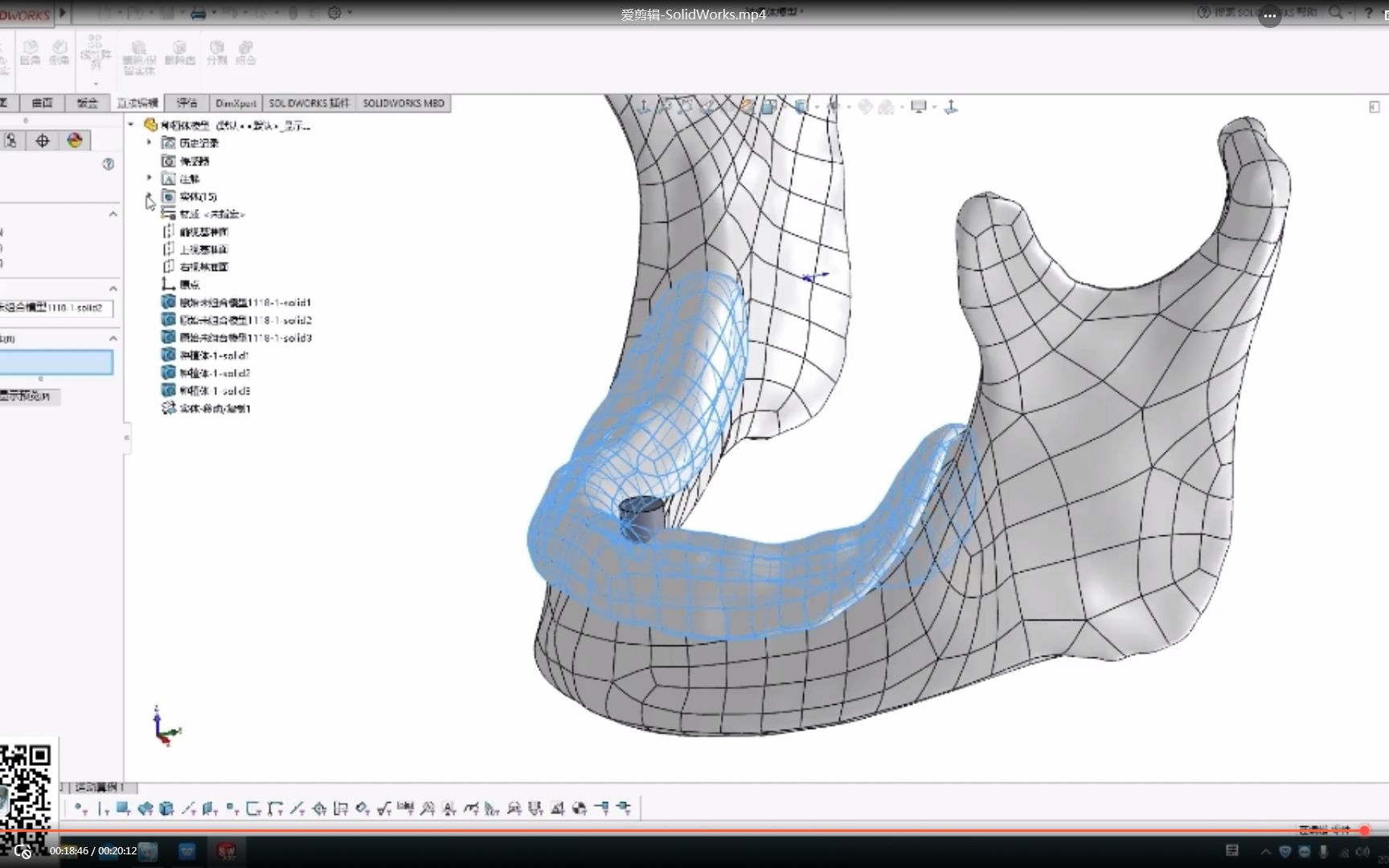 口腔种植体有限元分析(3)在SolidWorks中做种植体的建模和骨头装配哔哩哔哩bilibili