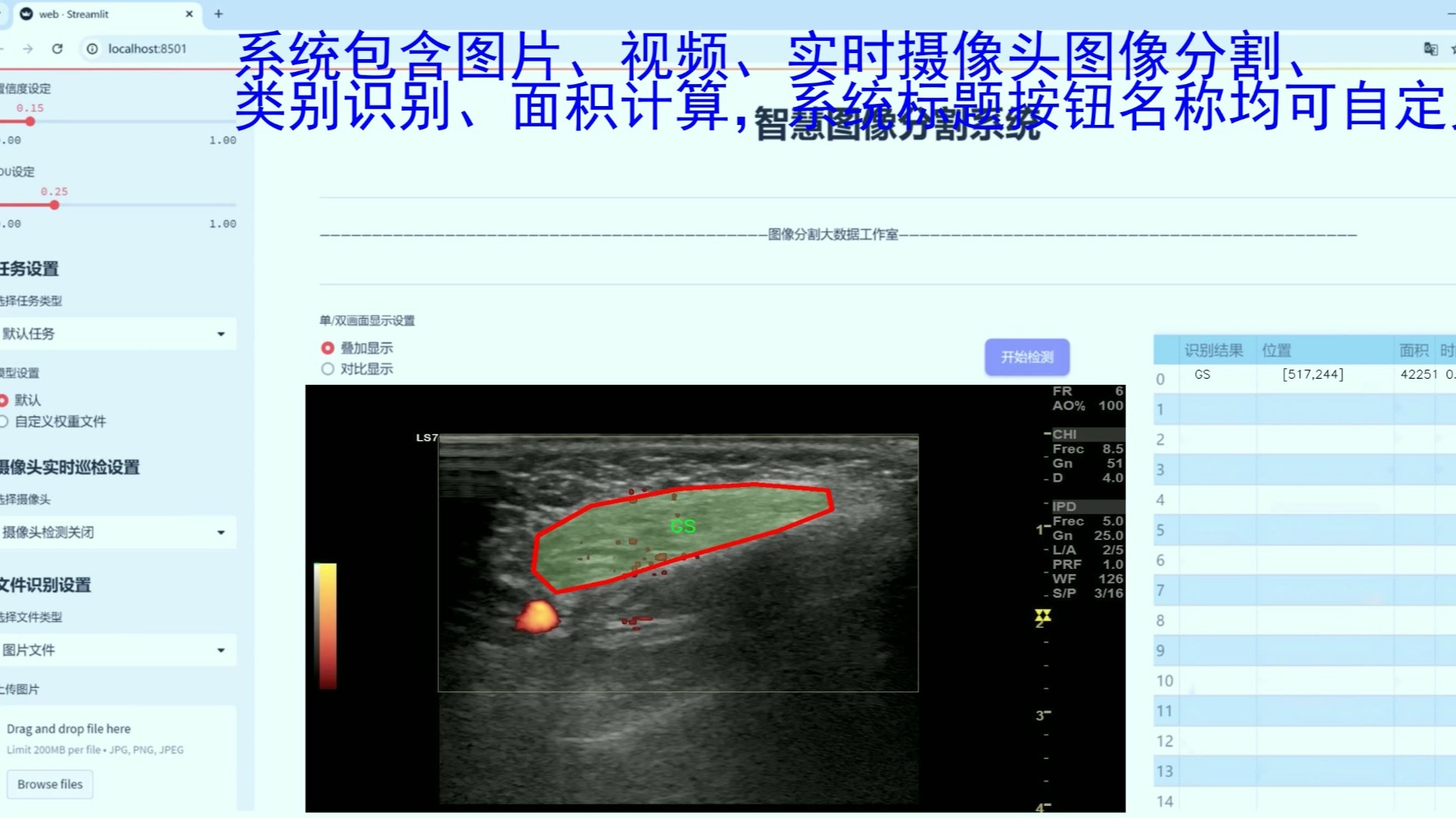 超声图像分割图片