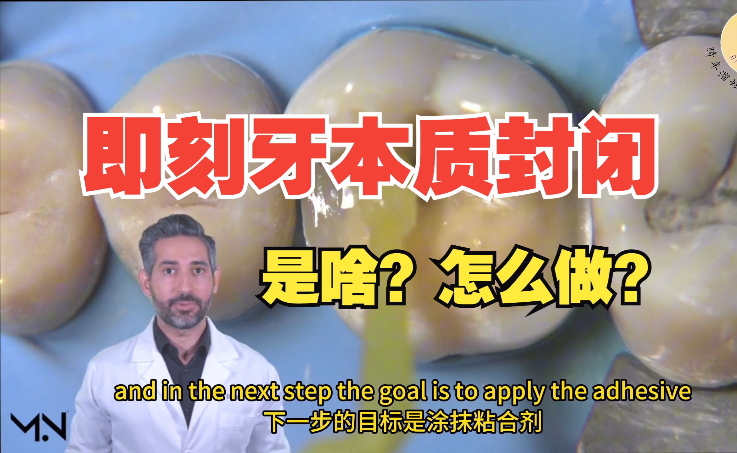 即刻牙本质封闭IDS(immediate dentin sealing )是什么?为什么?怎么做?哔哩哔哩bilibili