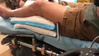 男子淡定躺在病床，腿上还插着一条鱼，网友：保大还是保小