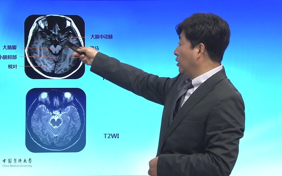 [图]头部影像解剖