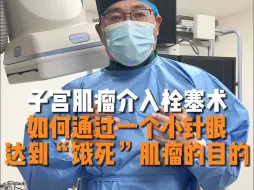 Download Video: 子宫肌瘤介入栓塞术，如何通过一个小针眼达到饿死肌瘤的目的