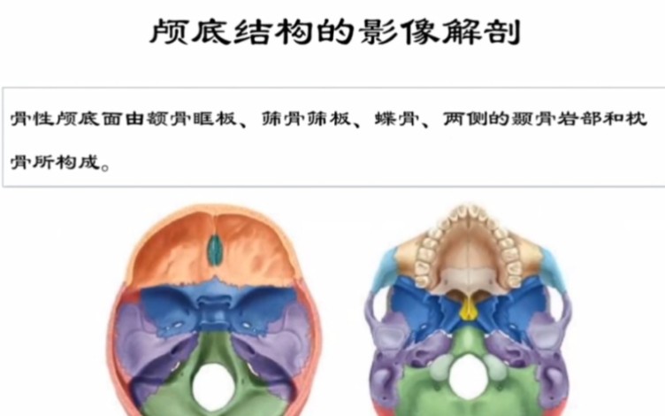 颅底骨性影像断层解剖结构CT哔哩哔哩bilibili