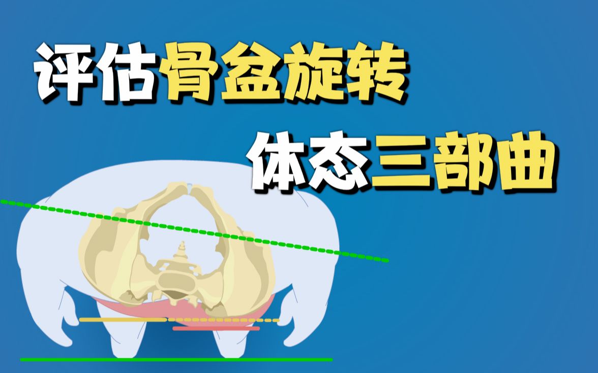 评估骨盆旋转体态三部曲