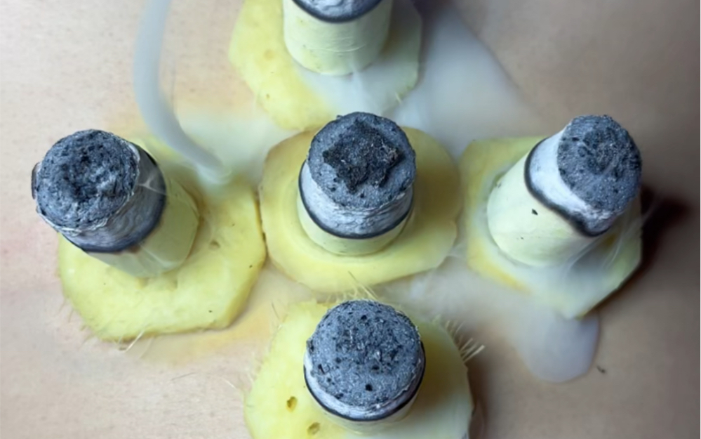 梅花灸的作用与功效(梅花灸:缓解疼痛,促进血液循环的好方法)