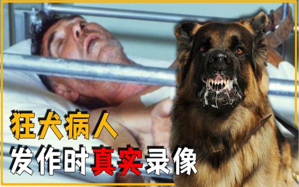 狂犬病真实患者图片图片