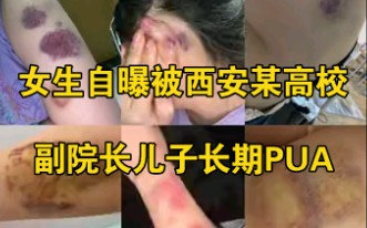 女生自曝被西安某高校副院长儿子长期PUA,身上伤痕累累触目惊心哔哩哔哩bilibili