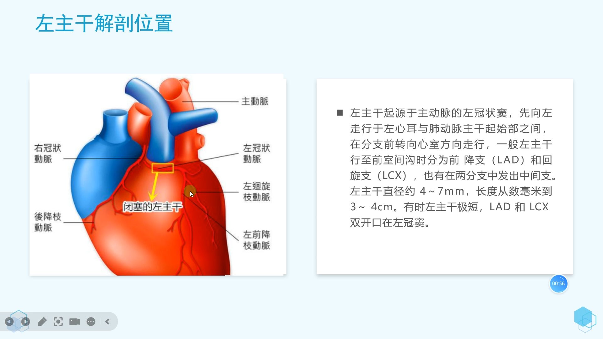 高危中的高危急性心梗之急性左主干心肌梗死心电图诊断哔哩哔哩bilibili