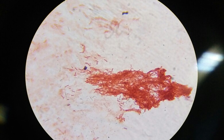 阴沟肠杆菌革兰氏染色图片