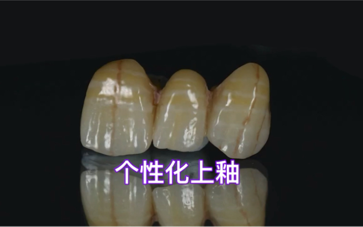 氧化锆个性化上釉by Bloomden zirconia#上釉#牙匠之家哔哩哔哩bilibili