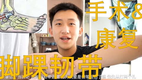 踝关节扭伤 外踝韧带撕裂 撕脱性骨折 受伤 手术 康复记录vlog5 哔哩哔哩