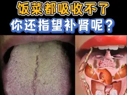 Download Video: 这脾虚的，这肾虚的，饭菜都吸收不了，你还指望补肾呢？