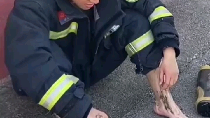 消防员受伤的脚图片