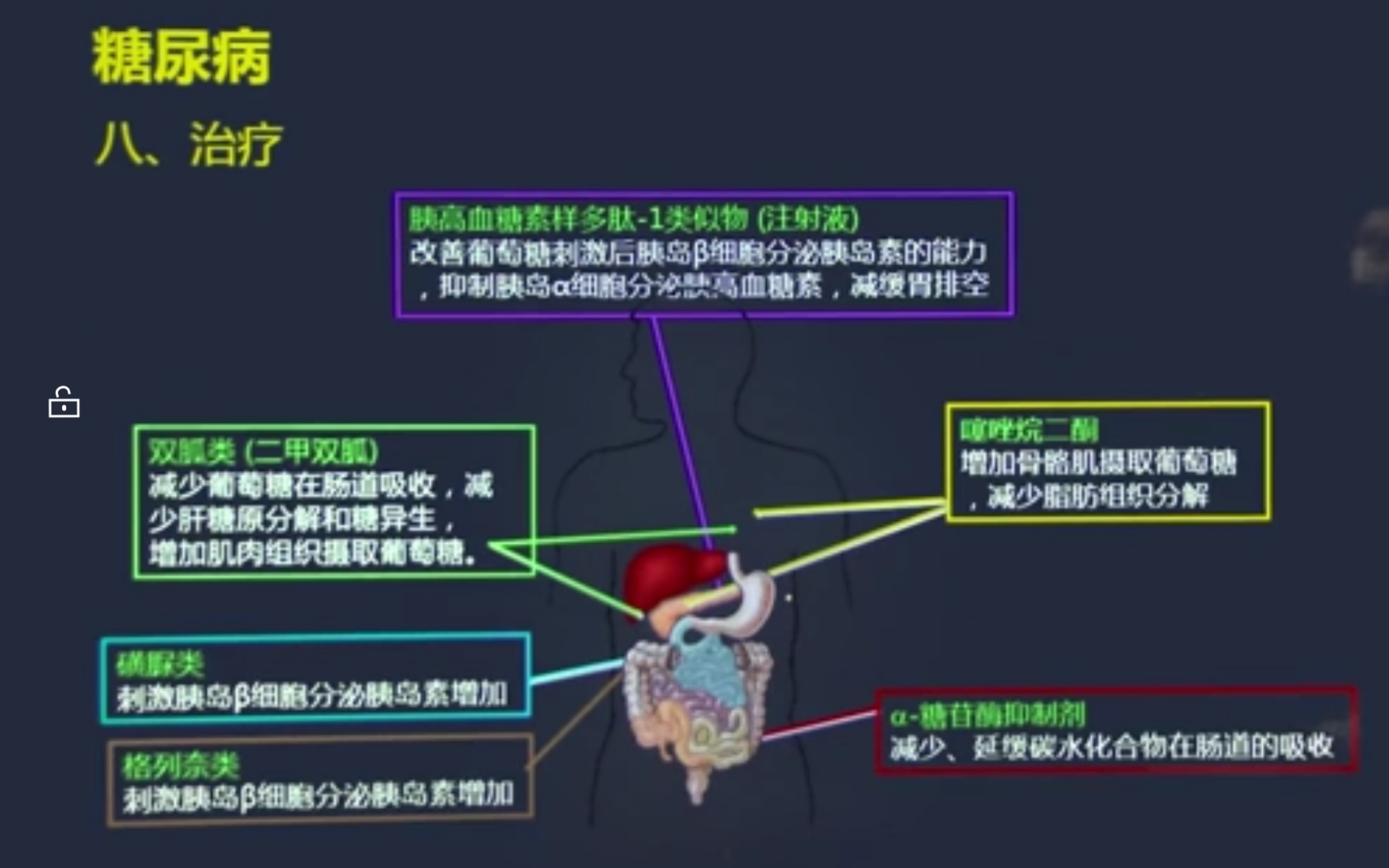 糖尿病(diabetes mellitus)lc思维哔哩哔哩bilibili