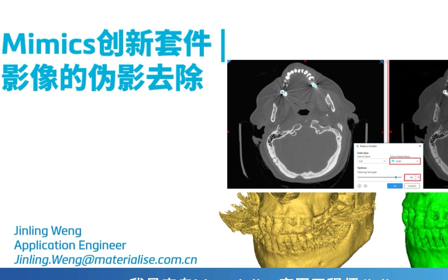 Mimics技巧分享 | 影像的伪影去除哔哩哔哩bilibili