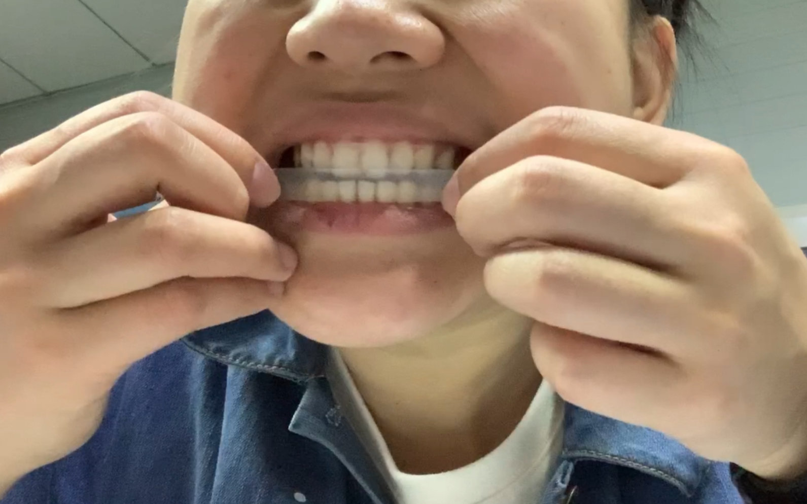 【第一次用美白牙贴】一贴见效,肉眼可见上门牙透亮的白