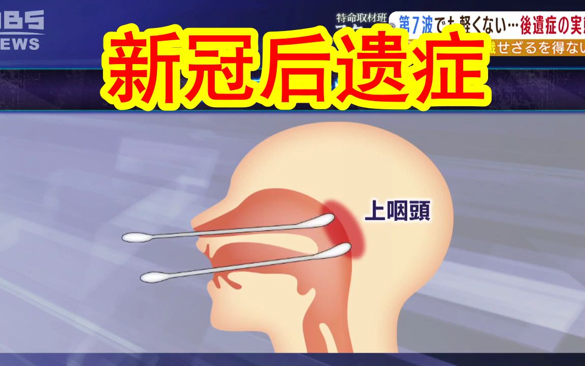 [图]【221006新冠后遗症纪录片】日本医生「12%的新冠患者会出现后遗症」新冠奥密克戎的症状虽轻，带来的后遗症可不轻。日本23岁年轻妹子患上新冠后遗症后，手脚麻