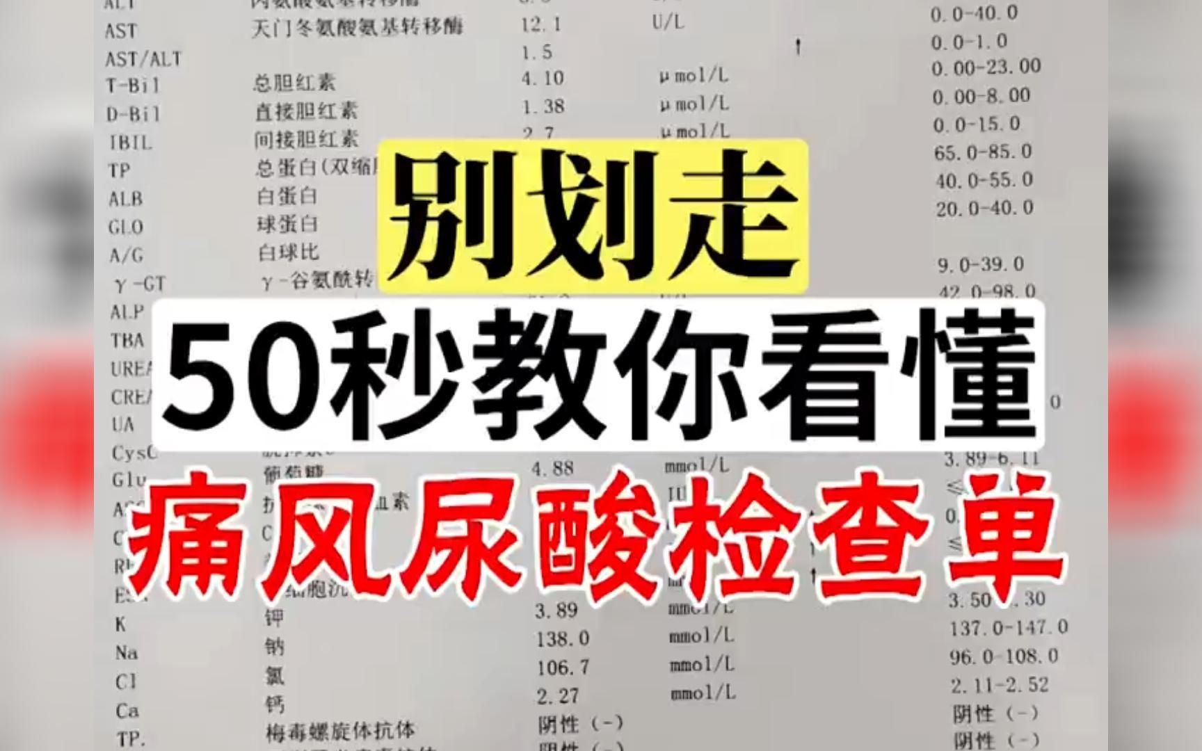 痛风尿酸检查单,你真的会看吗?50秒教你看懂!哔哩哔哩bilibili