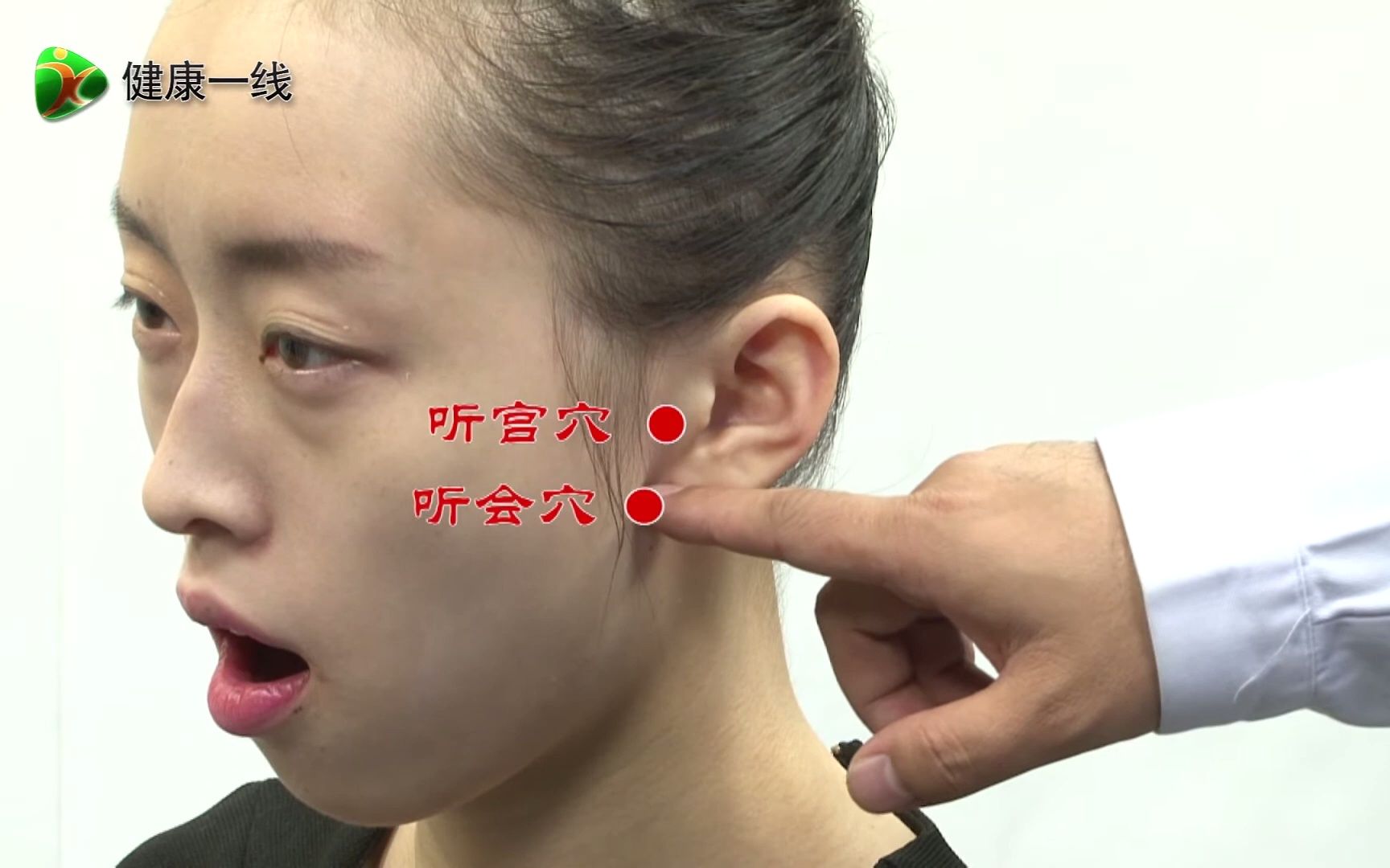 166. 耳聋、耳鸣怎么办？——按揉听宫听会穴