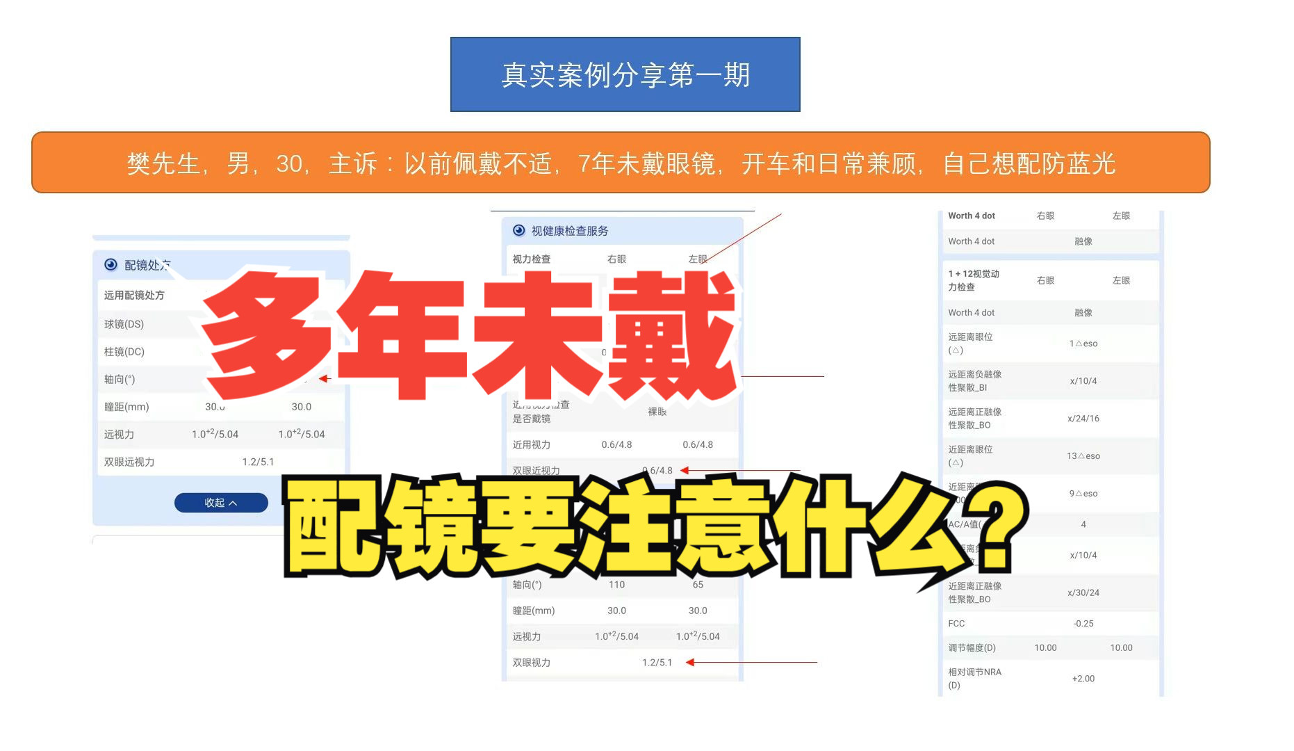 【真实案例分享】第一期:7年没有戴眼镜,在配镜处方上应该注意什么哔哩哔哩bilibili