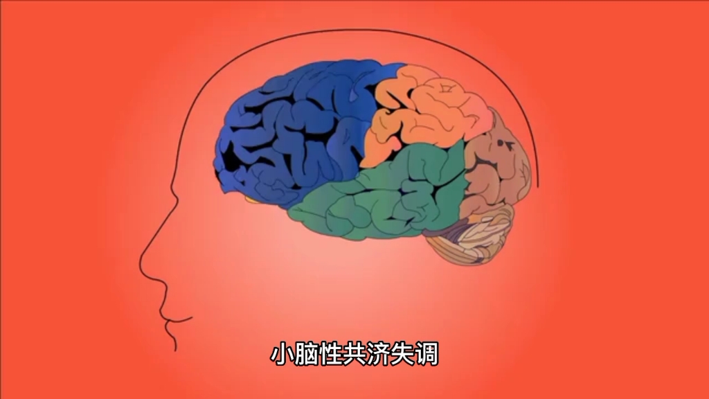 小脑性共济失调