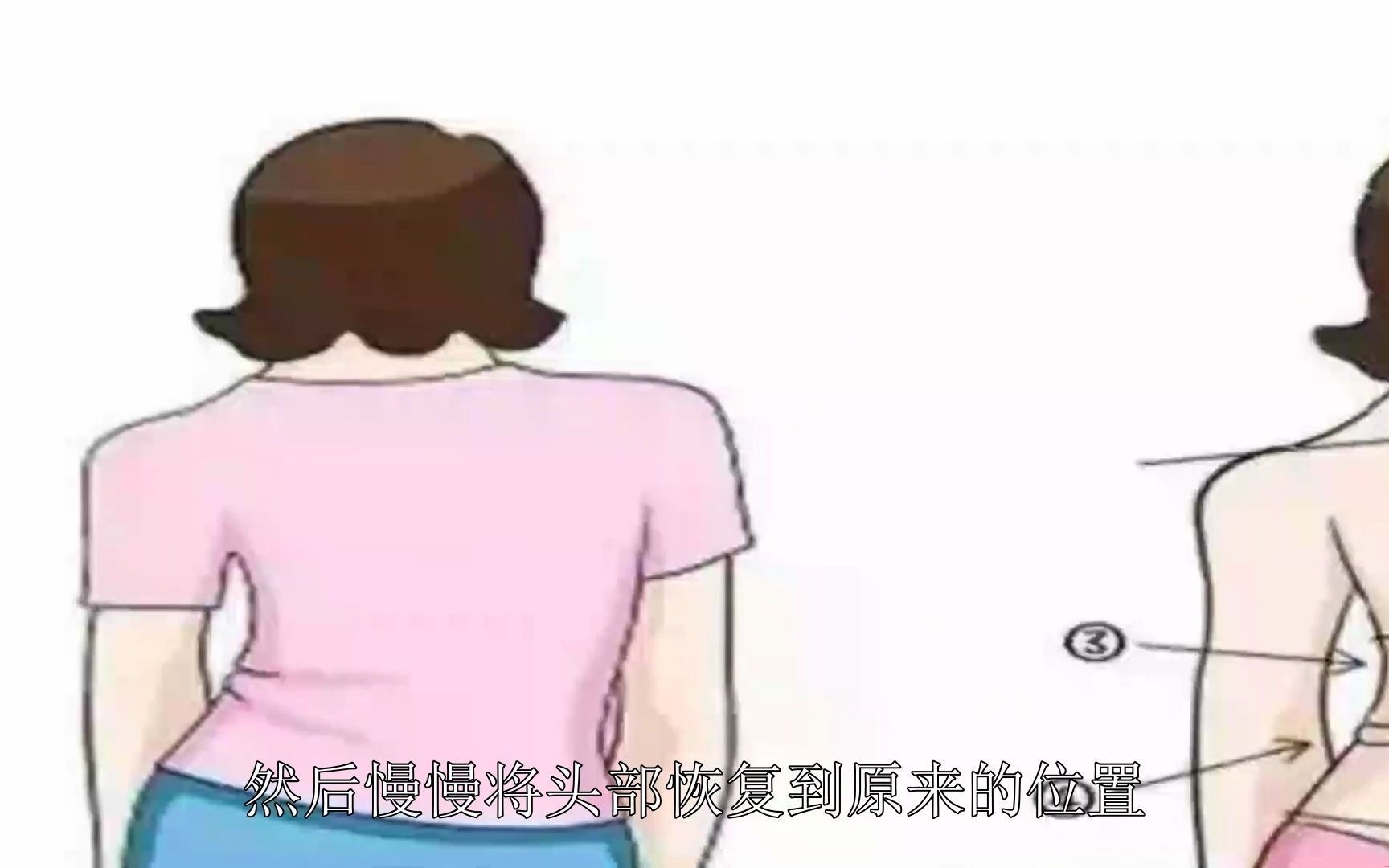 不良体态之探颈的矫正方法