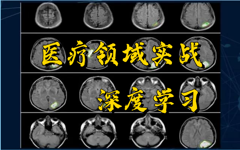 【全网最全深度学习在医学领域实战】从基因诊断到医疗影像分析,11个案例帮你读懂深度学习的应用!从入门到精通!人工智能/医疗影像/深度学习哔哩哔...