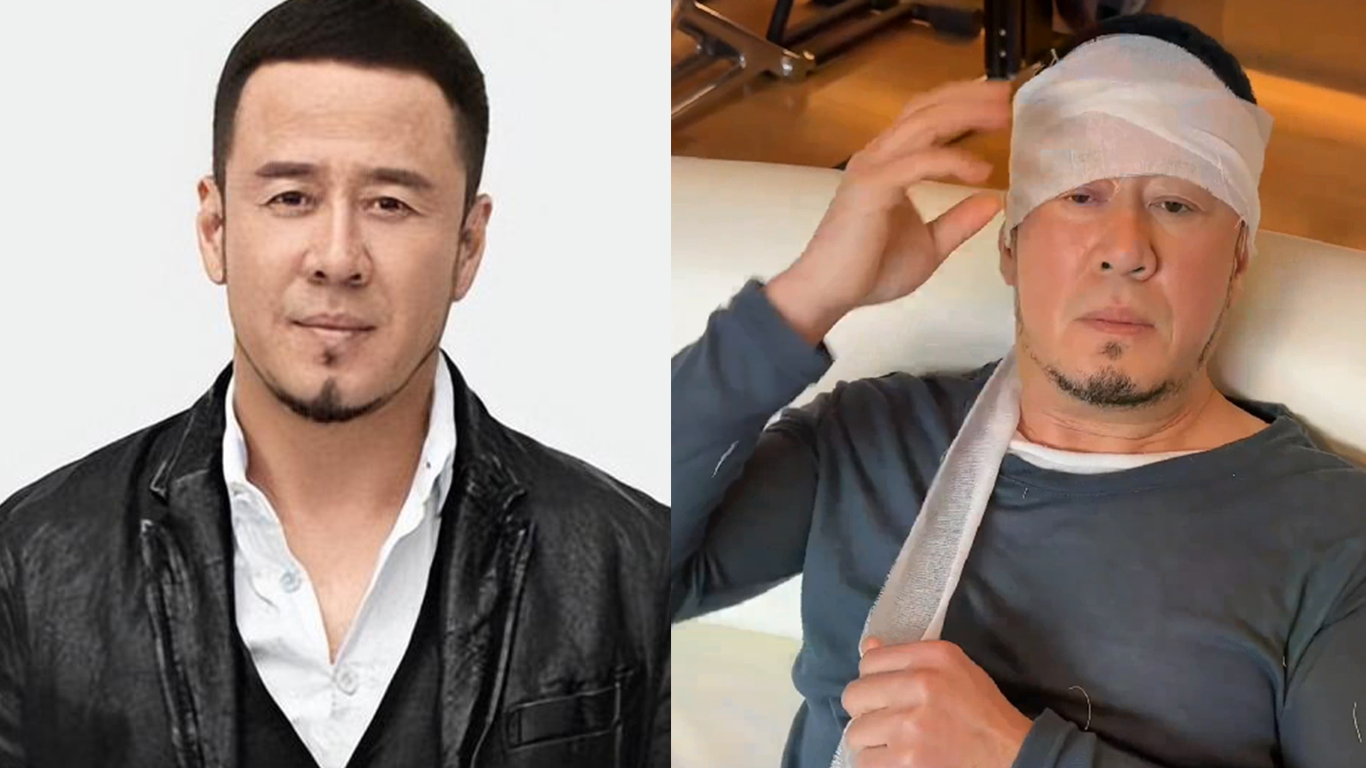 歌手杨坤辟谣演出后被围殴,缠满厚纱布露正常脸,受伤图是旧剧照