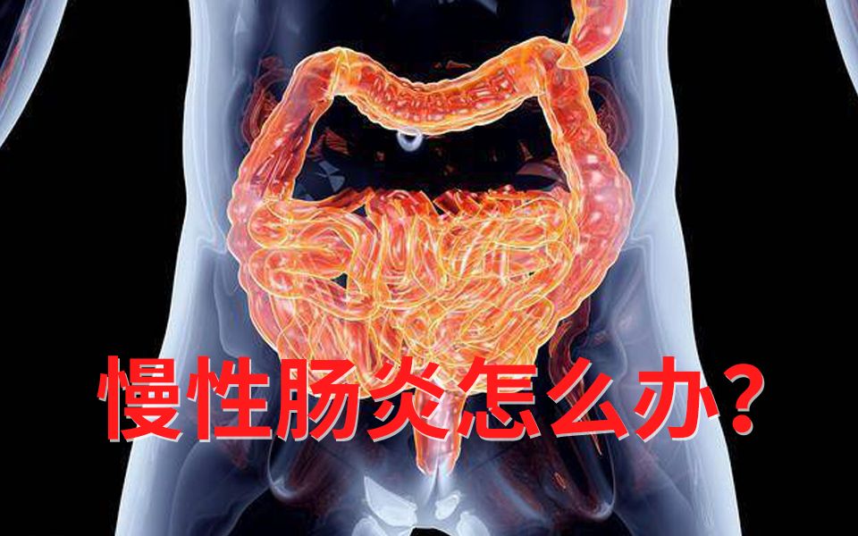 肠道不好,肠炎反复,经常闹肚子试试绿洲制药出品固本益肠片!