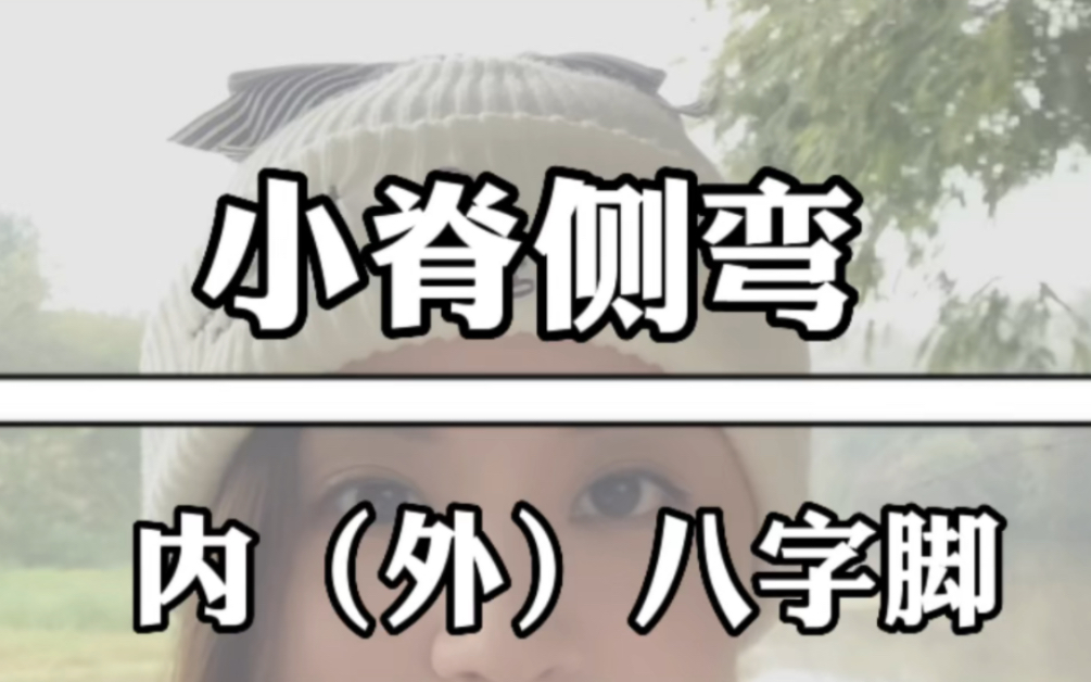 内八字脚,外八字脚