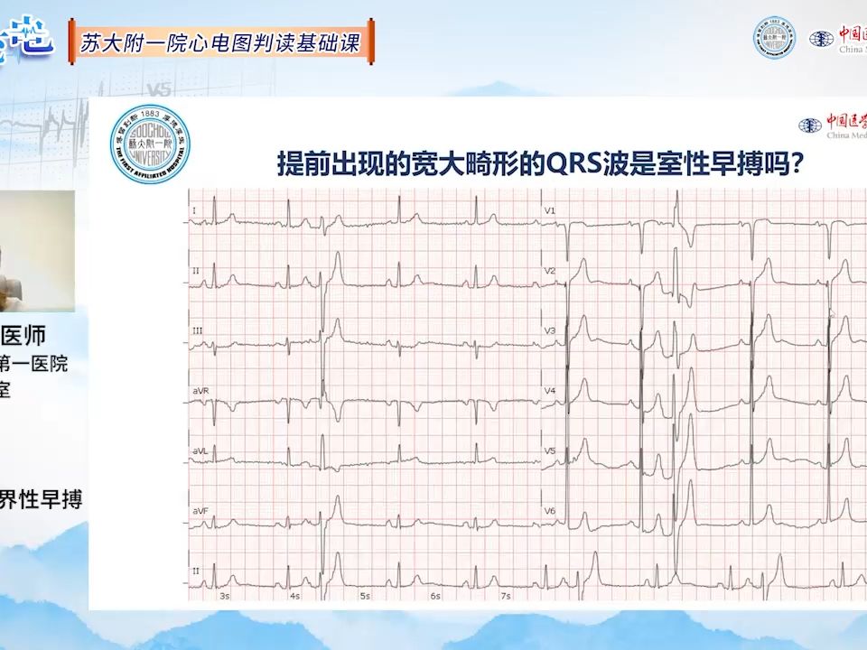 [图]赵茹：房性早搏与交界性早搏 _ 为“心”充“电”第4讲