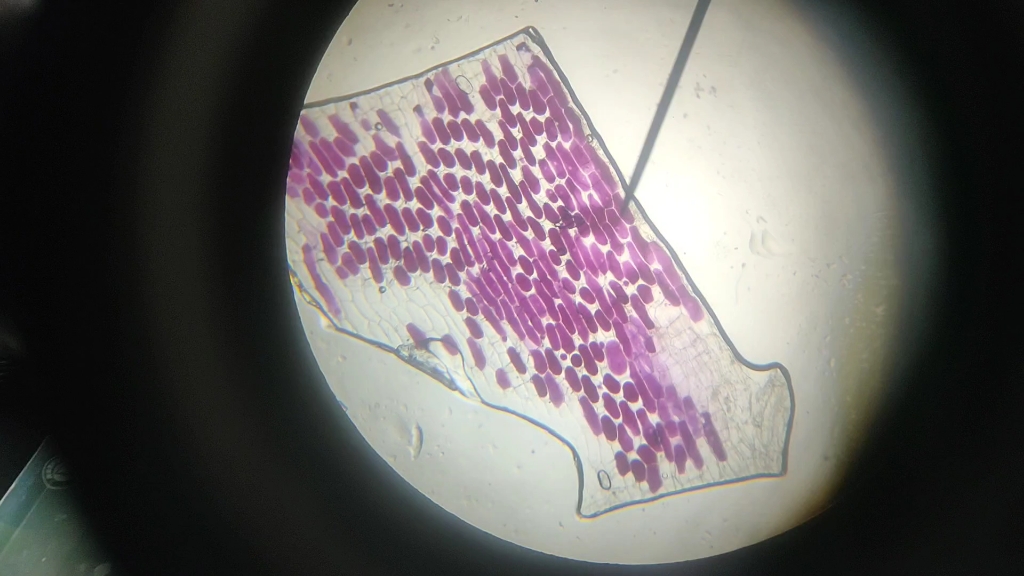 无忧无虑叶绿体和蕉绿到质壁分离叶表皮细胞 静音蕉绿版>