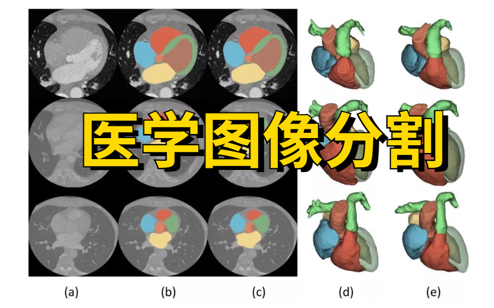 [图]研究生必看！图像分割经典项目实战之U-Net医学细胞分割实战,学不会UP主下跪！ 人工智能|深度学习|图像分割|图像处理