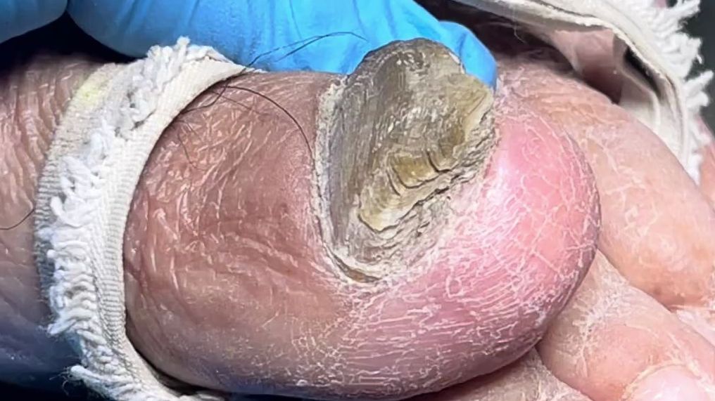 哇~又硬又厚的指甲,又黑又长,好脏