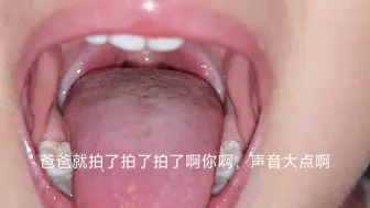 Download Video: 喉咙痛加口腔溃疡