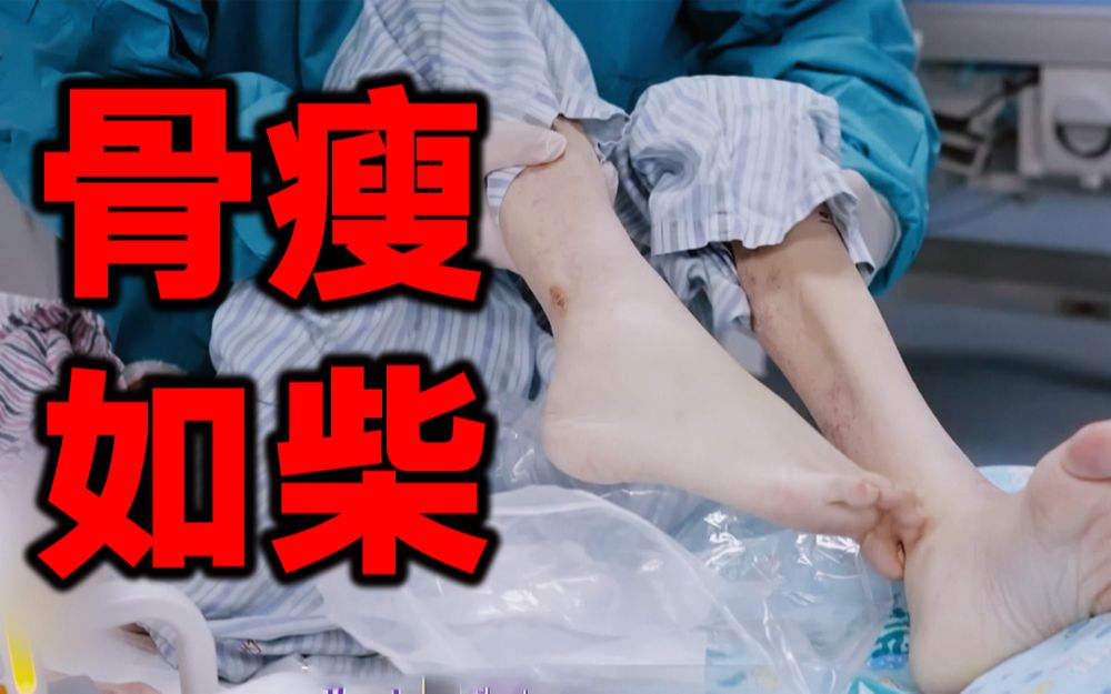 [图]【闪闪的儿科医生】看点3-5：女生为了喜欢的男生减肥瘦到只有24公斤