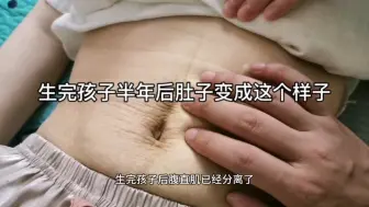 Download Video: 生完孩子后肚子除了有妊娠纹，还有那猪大肠的肚皮和我失去的青春