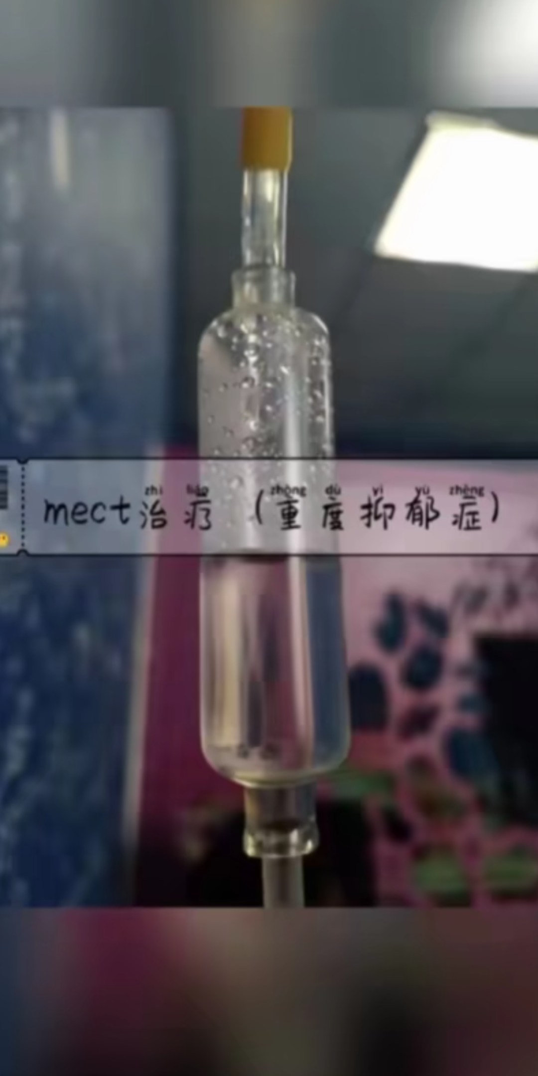 抗抑,MECT治疗.哔哩哔哩bilibili