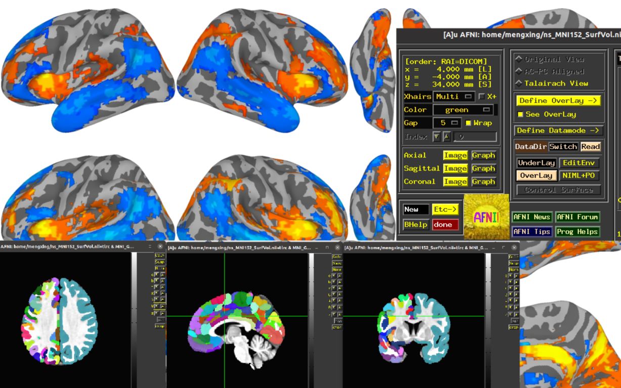 中文神经成像软件AFNI基本操作系列教程02AFNI的安装和配置哔哩哔哩bilibili