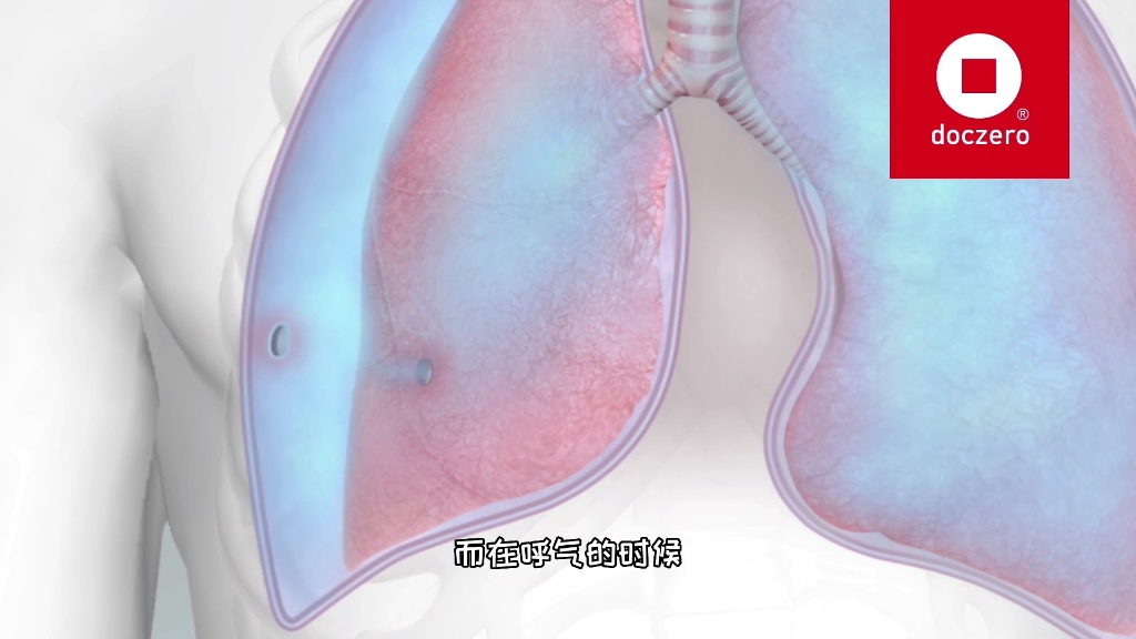[图]肺被捅破了的后果，开放性气胸的发生过程，3D演示。。