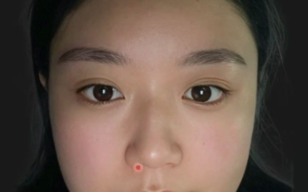 女人门牙大了好不好?