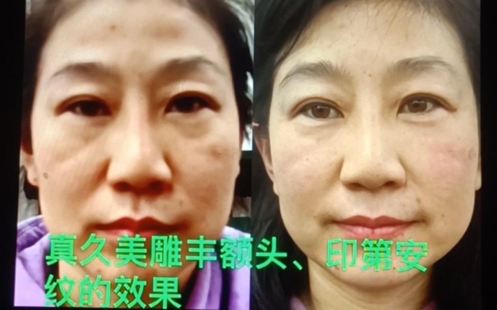 崔兰英真久美雕,丰额头,印第安纹的效果对比