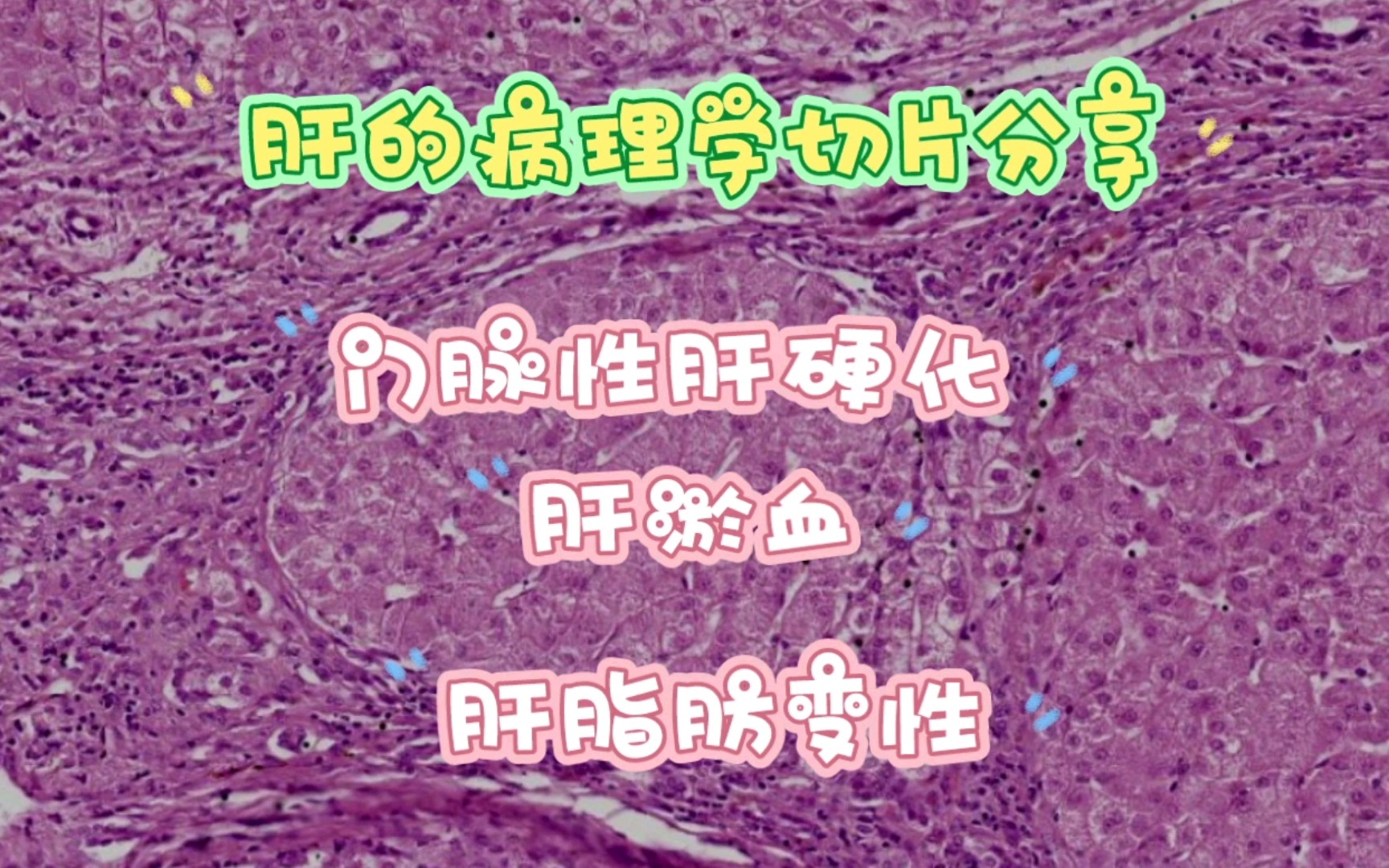 肝的病理学切片分享哔哩哔哩bilibili