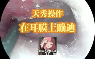 Download Video: 【沉浸式采耳】继续进行耳道清理