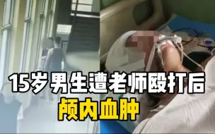 Download Video: 15岁男生遭老师殴打后颅内血肿 涉事老师：人是我打的，头是他道歉磕伤的